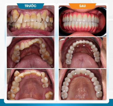 Slider image (2) Dr. Care Implant Clinic